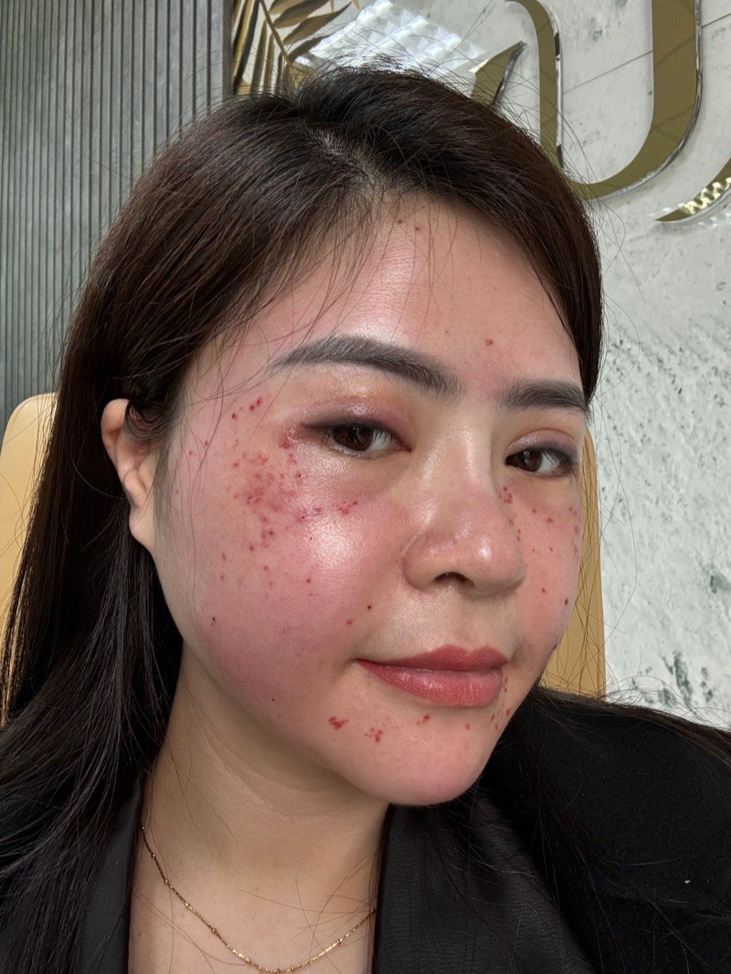 Ảnh thật làn da của người sáng lập Nguyệt Nữ, chưa qua chỉnh sửa