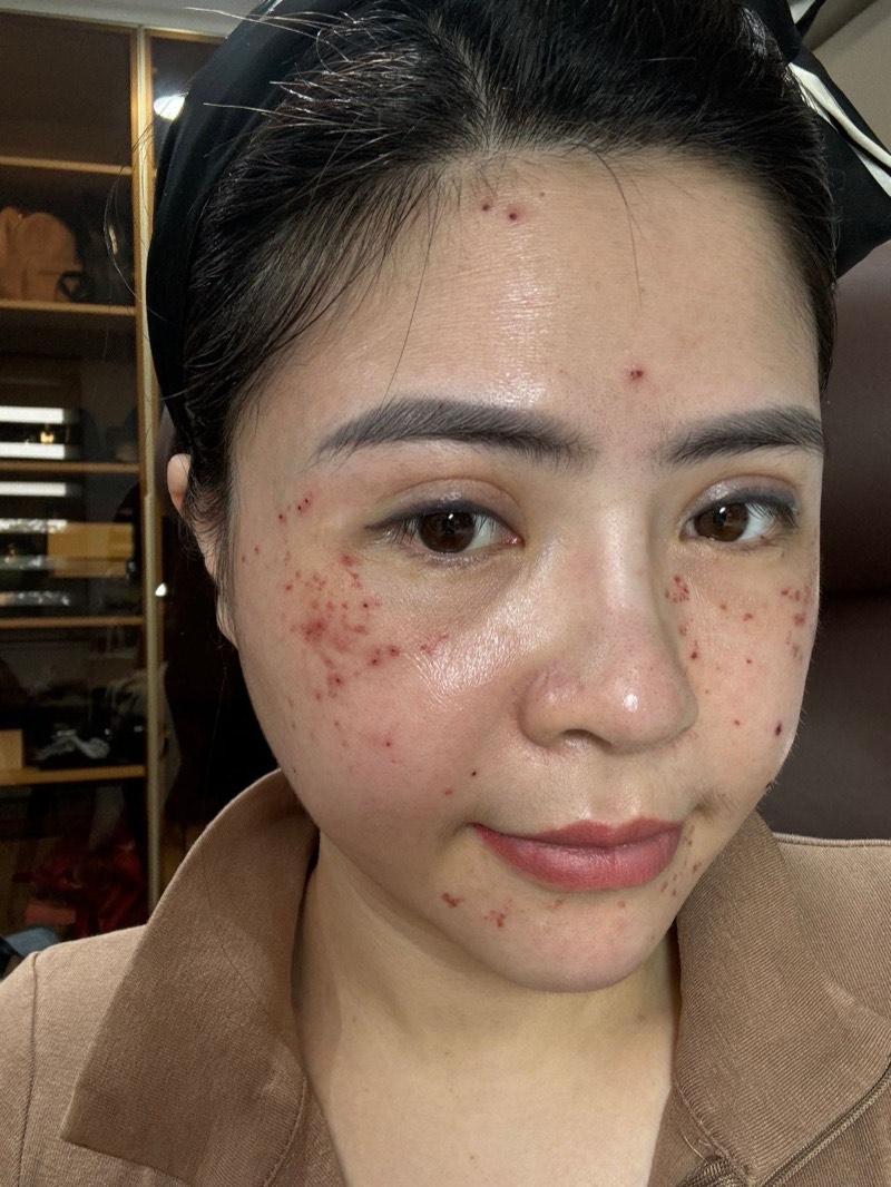Ảnh thật làn da của người sáng lập Nguyệt Nữ, chưa qua chỉnh sửa