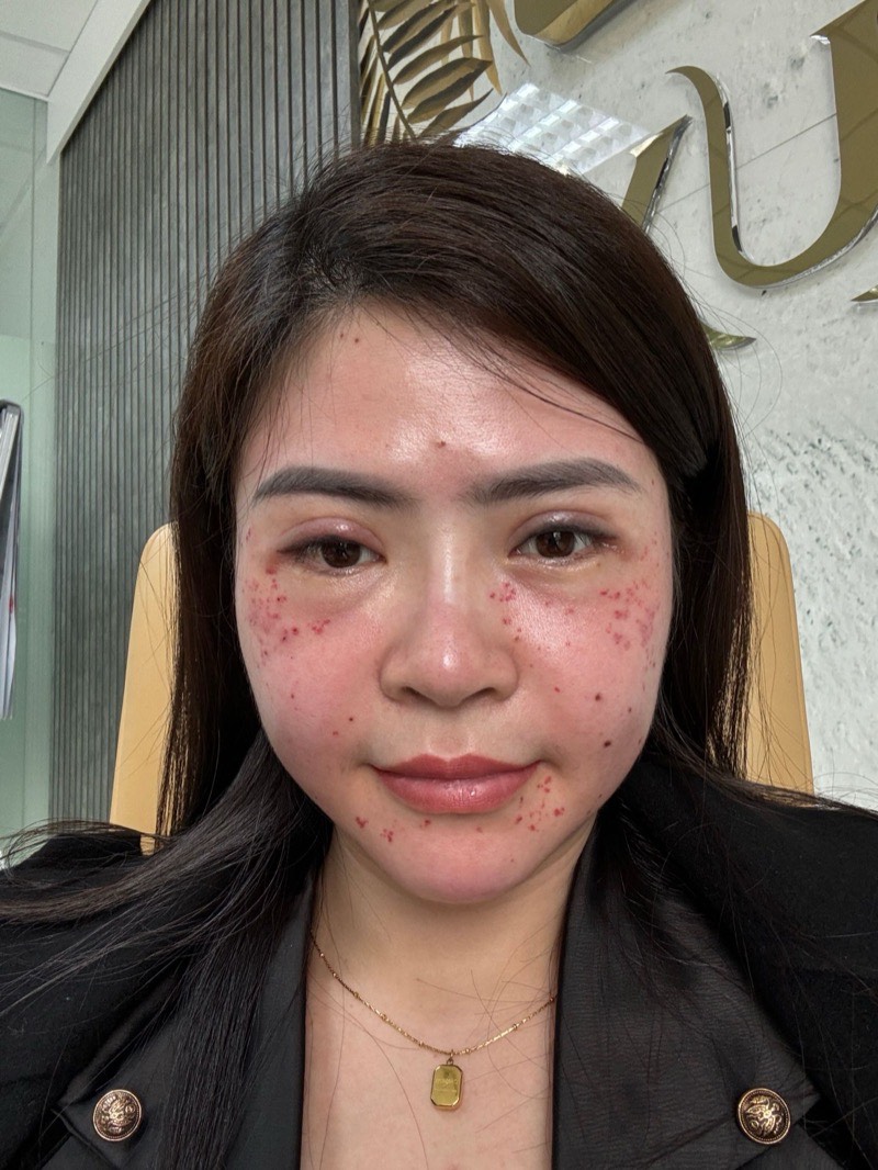 Ảnh thật làn da của người sáng lập Nguyệt Nữ, chưa qua chỉnh sửa
