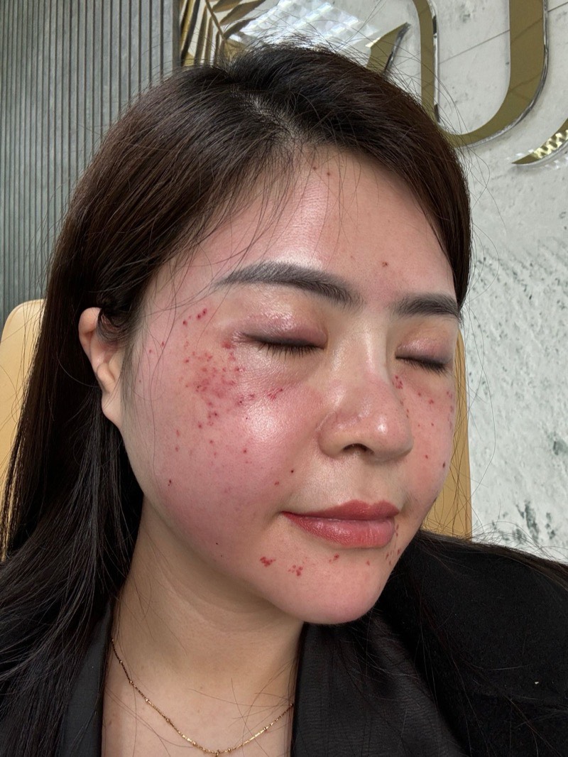 Ảnh thật làn da của người sáng lập Nguyệt Nữ, chưa qua chỉnh sửa