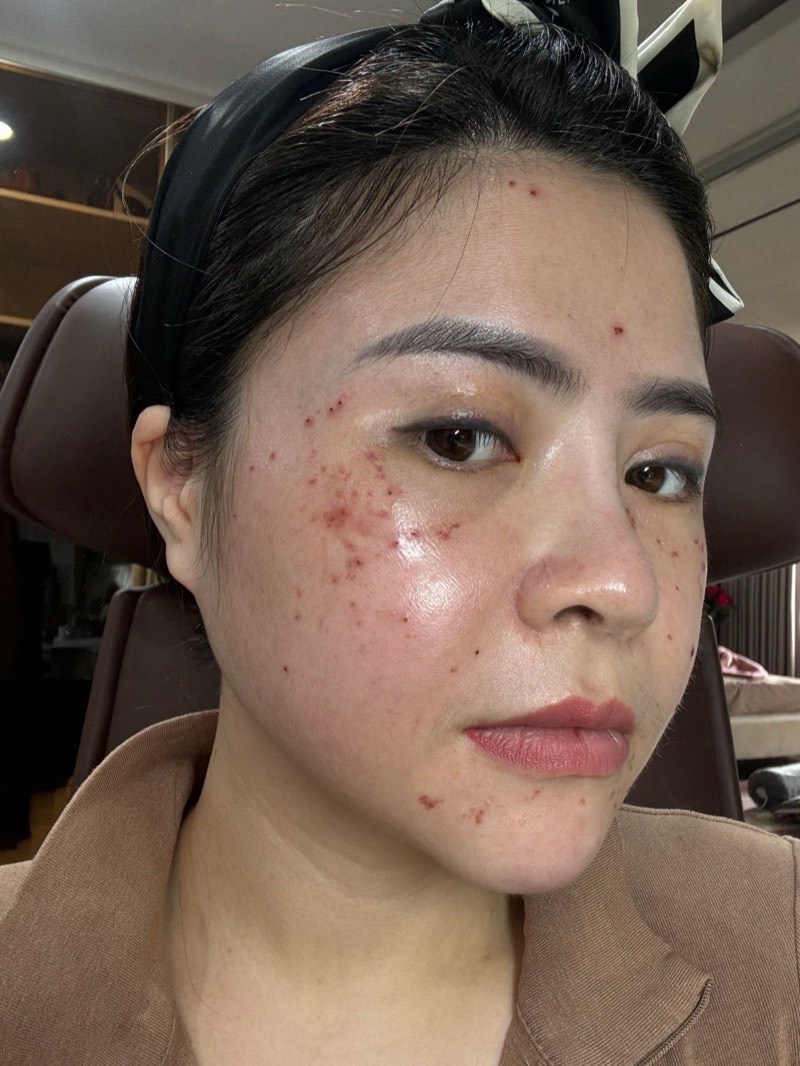 Ảnh thật làn da của người sáng lập Nguyệt Nữ, chưa qua chỉnh sửa