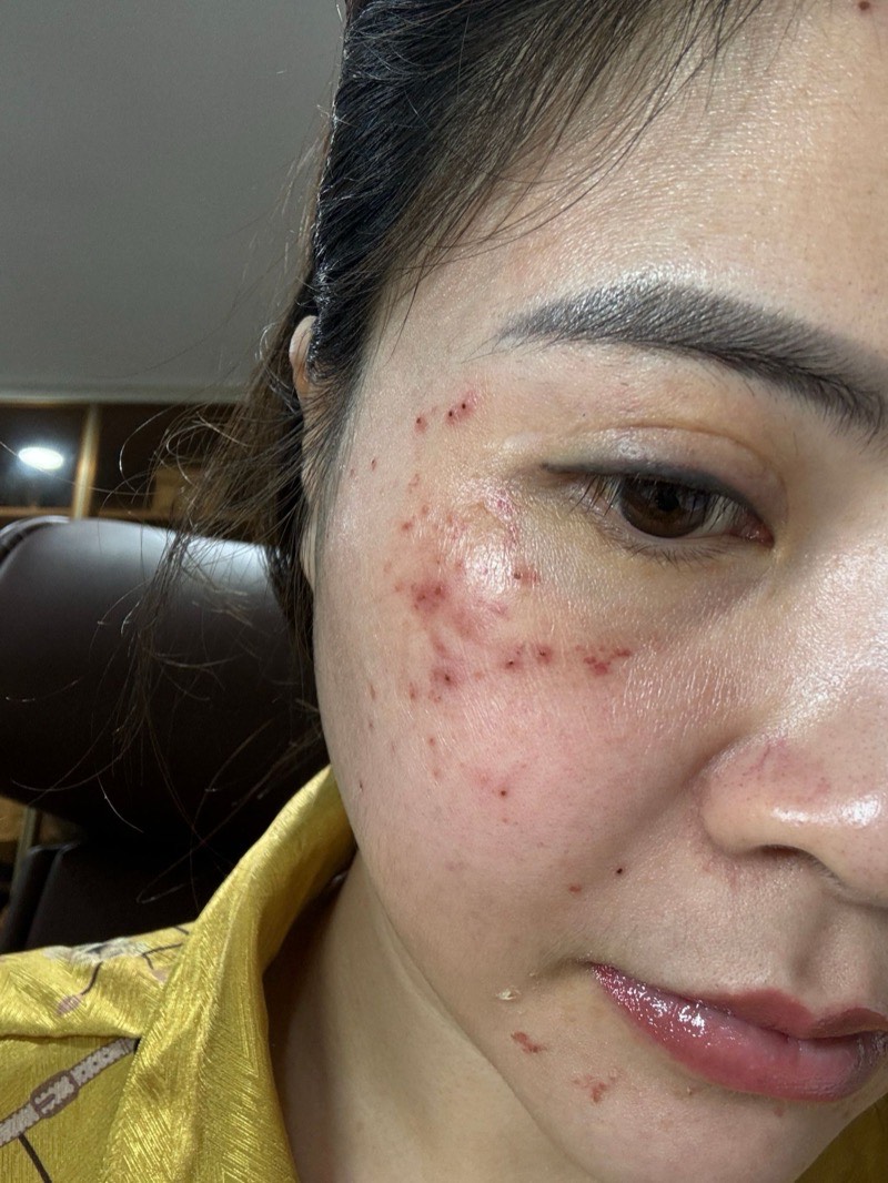 Ảnh thật làn da của người sáng lập Nguyệt Nữ, chưa qua chỉnh sửa